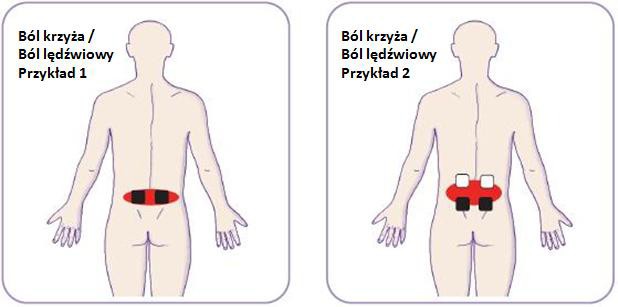 Umieszczanie elektrod na ciele