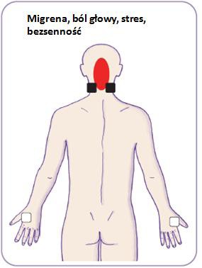 Umieszcanie elektrod przy migrenie, bólu głowy, stresie i bezsenności